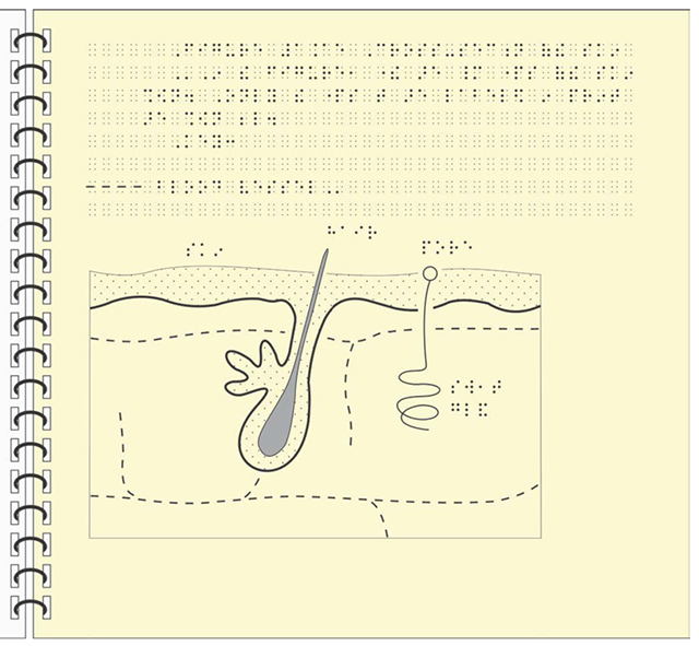 An illustration of the completed tactile diagram for the previous complex 3d figure. The illustration shows braille used to create a figure label, a brief tactile tour, and a legend. Below the braille is the 2 dimentional schematic representation of the 3d drawing. Different line types and shading are used to indicate features. The complexity was reduced significantly to just the pieces referred to in the text.