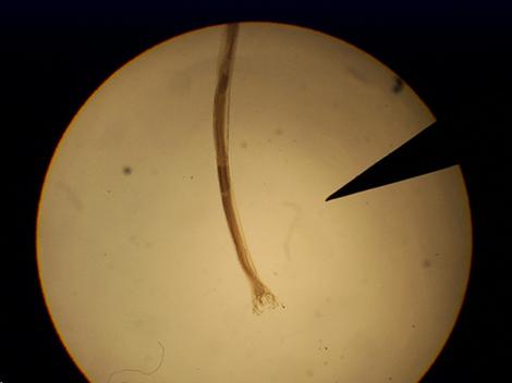 Photo of hookworm under a microscope